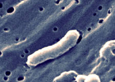 Photograph of long, tubular bacterium.