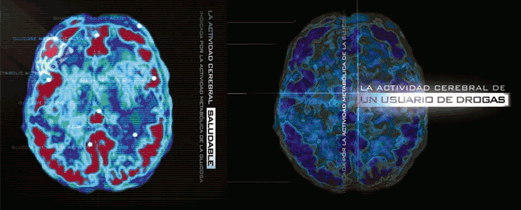 Drug User Brain Activity image