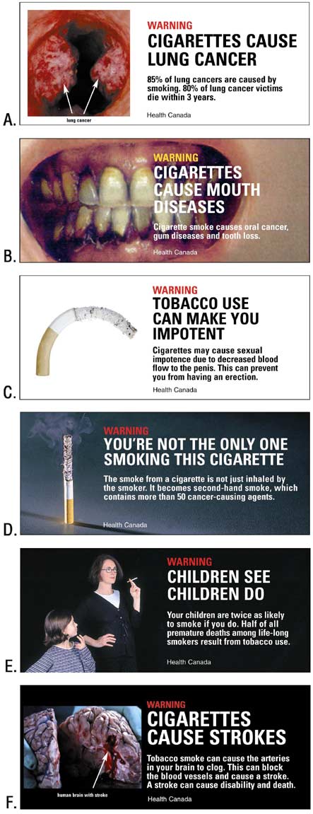 This is a series of six cigarette warning labels, A through F. Label A shows lungs with lung cancer and states, “Warning: Cigarettes cause lung cancer.” Label B displays an open mouth with dental problems and gum disease and the text, “Warning: Cigarettes cause mouth diseases.” Label C shows a curved, limp cigarette and the text, “Warning: Tobacco use can make you impotent.” Label D shows a burning cigarette standing on end with a caption about secondhand smoke that states, “Warning: You’re not the only one smoking this cigarette.” Label E shows a mother with a female child approximately aged 8 years with the text, “Warning: Children see, children do”. Label F displays a picture of a human brain following a stroke and the statement, “Warning: Cigarettes cause strokes.”