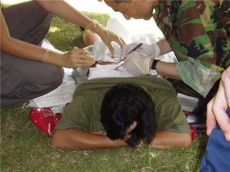 Dr. Park removing cyst from patient.  3P brings together host nation medical personnel, partner nation military medical personnel and non-governmental organizations (NGOs) to provide medical, dental, construction and other humanitarian-assistance programs ashore and afloat in Southeast Asia and Oceania (specifically Philippines, Vietnam, Papua New Guinea, Republic of Marshall Islands, and Solomon’s Island).