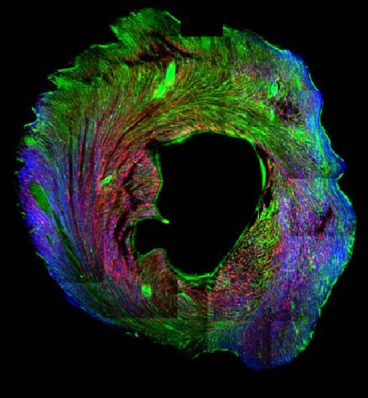 Three-Dimensional Multi-Scale Modeling of Mouse Hearts