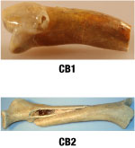 photos of tooth and bone