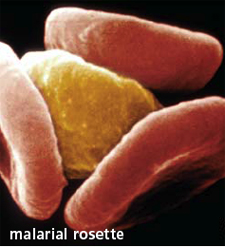 malarial rosette
