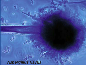 Aspergillus Flavus