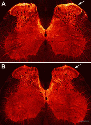 SP-SAP Treatment on Spinal Cord Nerve Cells