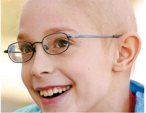 bald child with glasses