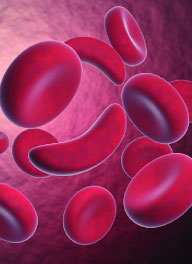 sickle cells