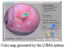 Screenshot of the LUMA system. Label: 