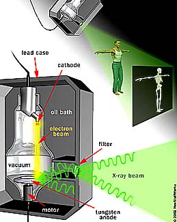 Schematic diagram of an x-ray generating tube assembly and of its using in examining the human body.