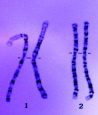 chromosomes