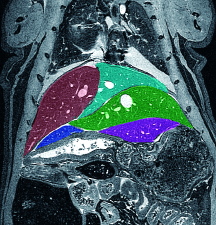 rat liver MRI.MRPath