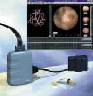 Cable-Free Endoscopy