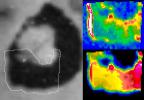 Io's Loki in Infrared: Hot Edge