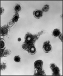 Transmission electron micrograph of varicella-zoster virions from vesicle fluid of patient with chickenpox.