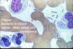 Plague bacteria in blood smear. Note safety pin appearance.