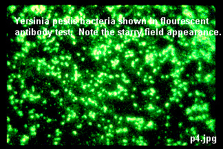 Image: Yersinia pestis bacteria shown in flourescent antibody test. Note the starry field appearance.