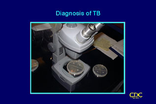 Slide 41 (Chapter title slide): Diagnosis of TB. Click for larger version.