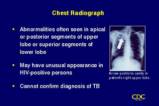 Slide 47: Chest Radiograph. Click for larger version.