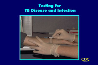 Slide 25 (Chapter title slide): Testing for TB Disease and Infection. Click here for larger image