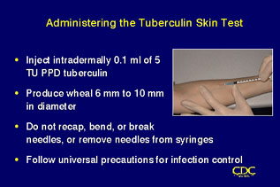 Slide 31: Administering the Tuberculin Skin Test. Click for larger version.