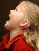 Image of a girl with a cochlear implant