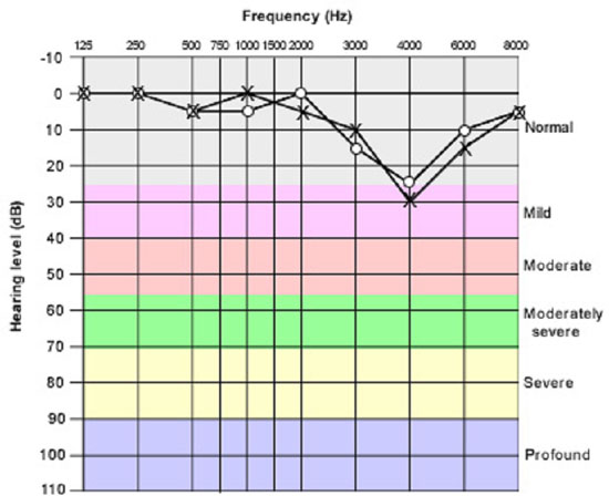 Case Study Graph