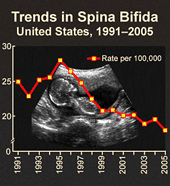 Chart: Trends in Spina Bifida, United States 1991-2005