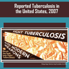 TB surveillance report