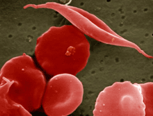 Scanning electron micrograph showing long cell at center among more disc-shaped cells.