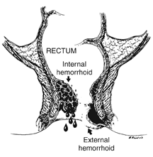 Illustration of rectum