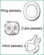 Illustration of ring pessary, cube pessary, and introl pessary
