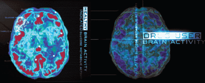 Drug User Brain Activity image
