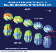 Images of Brain Development in Healthy Children and Teens (Ages 5-20)