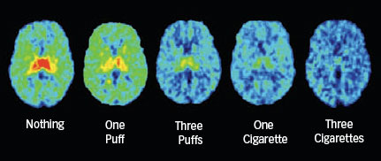 SMOKING SATURATES RECEPTORS - Brain scans