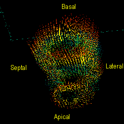 Three-dimensional motion tracking of the left ventricle of the human heart during contraction