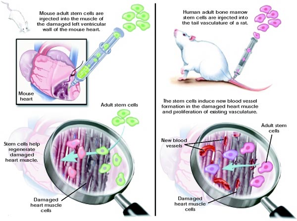 Graphic depicting heart muscle repair with adult stem cells