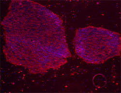 SSEA-4 stain image of cell line UC06(1)