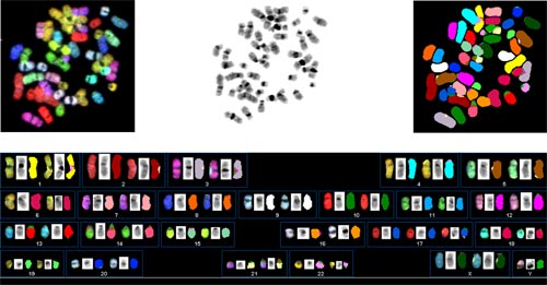 Left image: hES chromosomes after the simultaneous hybridization of 24 combinatorially labeled chromosome painting probes. Middle image: hES chromosome were stained with dapi, which used to compare within chromosomes and banding. Right image: Presentation of spectrabased classification colors. Bottom image: Karyotype of the SKY analysis from a normal female hES cell.