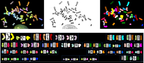 Left image: hES chromosomes after the simultaneous hybridization of 24 combinatiorially labeled chromosome painting probes. Middle image: hES chromosome were stained with dapi, which used to compare within chromosomes and banding. Right image: Presentation of spectrabased classification colors. Bottom image: Karyotype of the SKY analysis from a normal female hES cell.