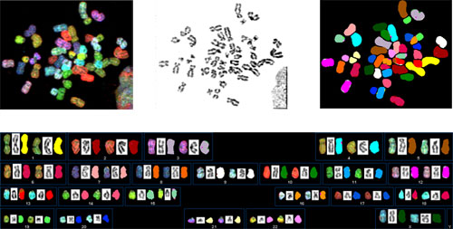Left image: hES chromosomes after the simultaneous hybridization of 24 combinatiorially labeled chromosome painting probes. Middle image: hES chromosome were stained with dapi, which used to compare within chromosomes and banding. Right image: Presentation of spectrabased classification colors. Bottom image: Karyotype of the SKY analysis from a normal female hES cell.