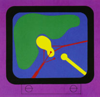 Conference artwork depicting stylized figures of the  liver, gall bladder, ducts and a laparoscope in bright colors.
