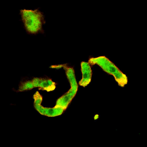 Aggregated Dictyostelium