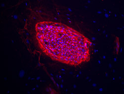 TRA-1-81 stain image of cell line TE06