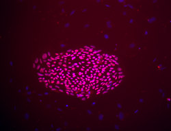 Oct-4 stain image of cell line TE06