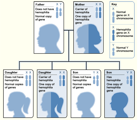 Illustration: Inheritance of Hemophilia Carrier Mother and Father Without Hemophilia