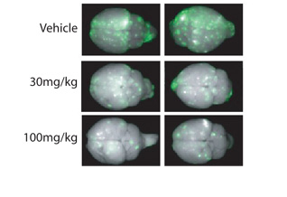 Representative image of brains from mice injected with 231 BR Her2 cell line