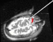 MRI-generated image