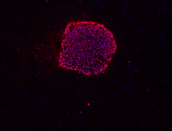 TRA-1-60 stain image of cell line BG02