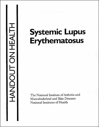 Systemic Lupus Erythematosus, Handout on Health, Large Print cover