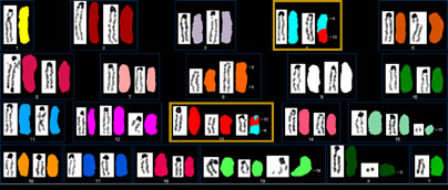 a multispectral karyotype